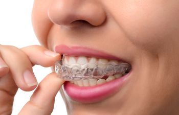 Invisalign® Costs Marietta, GA