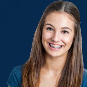 Marietta GA Orthodontist | West Cobb Invisalign | Kennesaw Clear Braces