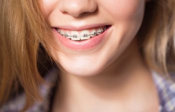 🥇 Orthodontic Treatment for Your Child