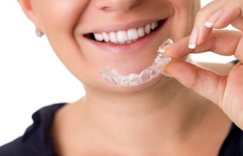 Clear Aligners, 